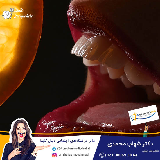 با روش‌های طراحی لبخند فانتزی در کلینیک های دندانپزشکی زیبایی آشنا شوید - کلینیک دندانپزشکی دکتر شهاب محمدی